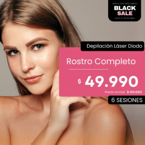 Black Sale | Rostro Completo