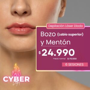 CYBER | Bozo + Mentón
